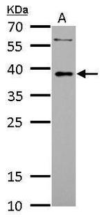 LDB3 Antibody in Western Blot (WB)