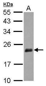 NUDT3 Antibody in Western Blot (WB)