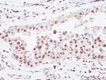 U2AF2 Antibody in Immunohistochemistry (Paraffin) (IHC (P))