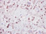 HELIOS Antibody in Immunohistochemistry (Paraffin) (IHC (P))