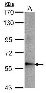 ABLIM3 Antibody in Western Blot (WB)