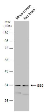 MAPRE3 Antibody in Western Blot (WB)