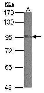 NCAPH Antibody in Western Blot (WB)