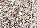 PATZ1 Antibody in Immunohistochemistry (Paraffin) (IHC (P))