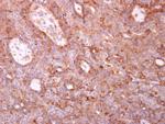 Coronin 3 Antibody in Immunohistochemistry (Paraffin) (IHC (P))