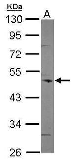 Coronin 3 Antibody in Western Blot (WB)