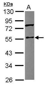 Coronin 3 Antibody in Western Blot (WB)