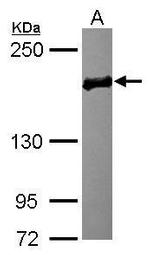 EDC4 Antibody in Western Blot (WB)