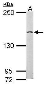 EDC4 Antibody in Western Blot (WB)