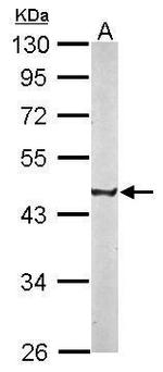 CREST Antibody in Western Blot (WB)