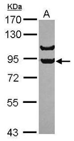 APPL1 Antibody in Western Blot (WB)