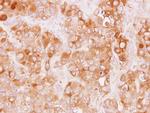 TRAF3IP1 Antibody in Immunohistochemistry (Paraffin) (IHC (P))