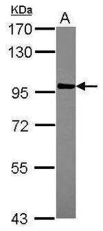 AKAP8L Antibody in Western Blot (WB)