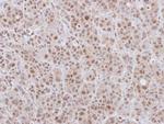 DCPS Antibody in Immunohistochemistry (Paraffin) (IHC (P))