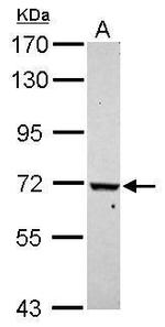 WDR91 Antibody in Western Blot (WB)