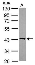 PSAT1 Antibody in Western Blot (WB)