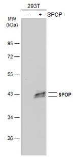 SPOP Antibody in Western Blot (WB)