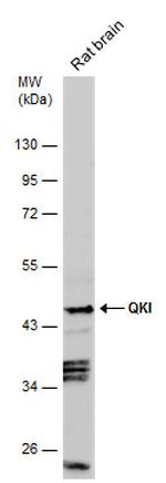 QKI Antibody in Western Blot (WB)