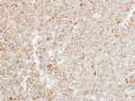 MTHFS Antibody in Immunohistochemistry (Paraffin) (IHC (P))