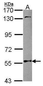 NMT2 Antibody in Western Blot (WB)