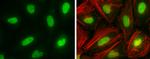 DNMT1 Antibody in Immunocytochemistry (ICC/IF)