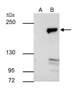 DNMT1 Antibody in Immunoprecipitation (IP)