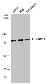 DNMT1 Antibody in Western Blot (WB)