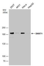 DNMT1 Antibody in Western Blot (WB)