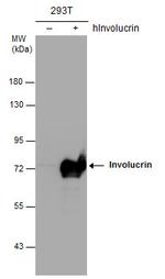 Involucrin Antibody in Western Blot (WB)