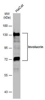 Involucrin Antibody in Western Blot (WB)