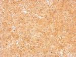 LOR Antibody in Immunohistochemistry (Paraffin) (IHC (P))