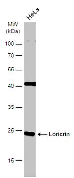 LOR Antibody in Western Blot (WB)