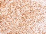 MRP1 Antibody in Immunohistochemistry (Paraffin) (IHC (P))