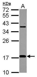 LC3B Antibody in Western Blot (WB)