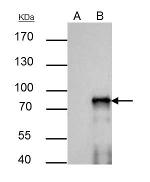 SOX6 Antibody in Immunoprecipitation (IP)