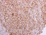 NOSIP Antibody in Immunohistochemistry (Paraffin) (IHC (P))