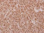 NOSIP Antibody in Immunohistochemistry (Paraffin) (IHC (P))