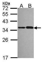 NOSIP Antibody in Western Blot (WB)