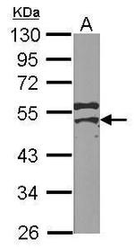 YBX2 Antibody in Western Blot (WB)