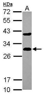 DCXR Antibody in Western Blot (WB)