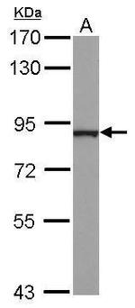 NCKIPSD Antibody in Western Blot (WB)