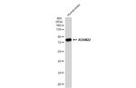 ADAM22 Antibody in Western Blot (WB)