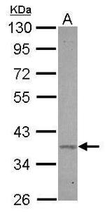 BXDC2 Antibody in Western Blot (WB)