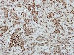 Macro H2A.2 Antibody in Immunohistochemistry (Paraffin) (IHC (P))