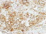 Vezatin Antibody in Immunohistochemistry (Paraffin) (IHC (P))