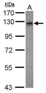 Vezatin Antibody in Western Blot (WB)