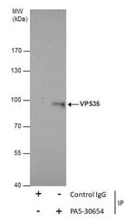 VPS35 Antibody in Immunoprecipitation (IP)