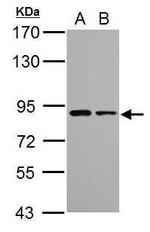 VPS35 Antibody in Western Blot (WB)