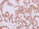 USP47 Antibody in Immunohistochemistry (Paraffin) (IHC (P))