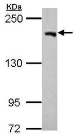 USP47 Antibody in Western Blot (WB)